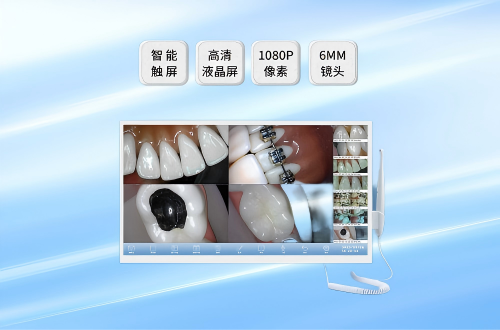 口腔镜显示终端